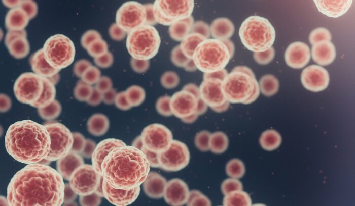Cancer cells, for article on multi-cancer blood test