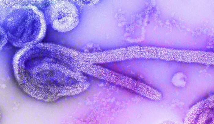 |Virus
