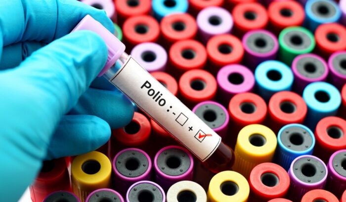 Polio vial, for article on wild poliovirus eradication