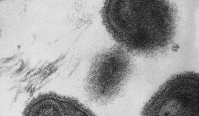 Smallpox virions, for article on smallpox eradication