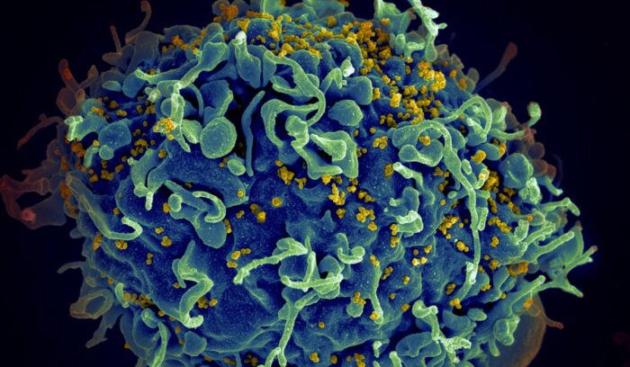 Virus up close, for article on lenacapavir HIV prevention
