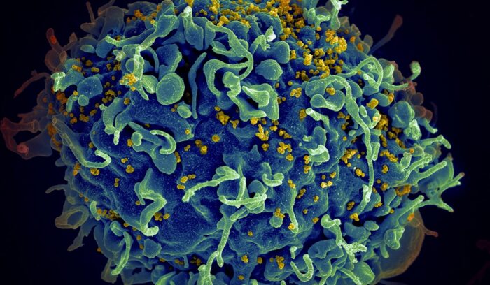 Good news for public health, for article on CAB-LA HIV prevention, for article on lenacapavir HIV prevention