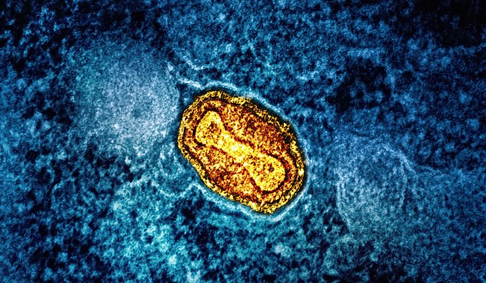 image for article on mpox diagnostic test