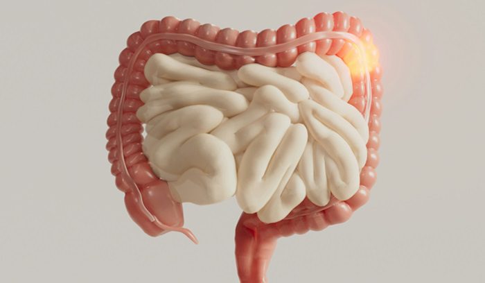Depiction of intestines, for article on dostarlimab FDA breakthrough designation, for article on dostarlimab FDA Breakthrough Designation