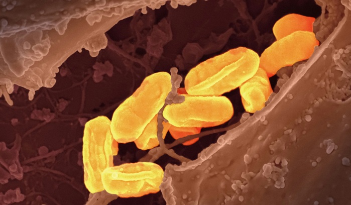 Bacteria under microscope