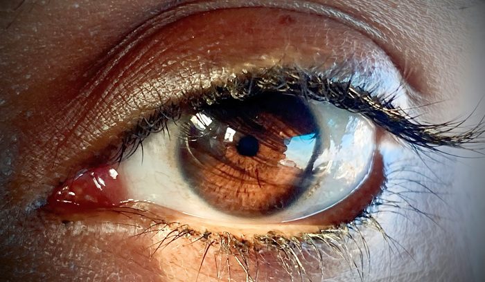 A rural health worker examines a child's eye in bright sunlight for an article about trachoma elimination in Egypt