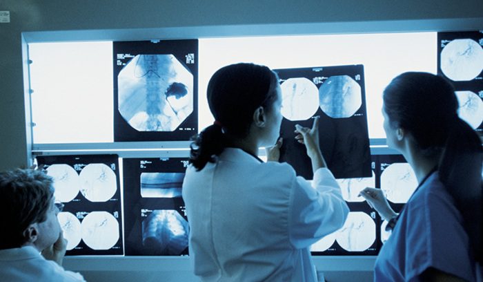 A researcher examines cancer cells under a microscope for an article about pancreatic tumor regression — 14 words.