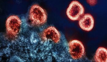 HIV up close, for article on mother-to-child HIV transmission