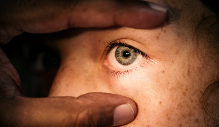 Eye exam, for article on trachoma elimination