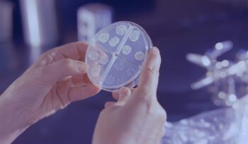Mycobacterium tuberculosis drug susceptibility test., for article on antibiotic resistance